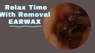 P15Safe Methods for Ear Wax RemovalHELLO HEALTH asmr [upl. by Eanrahs591]