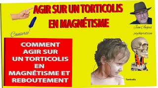 Agir sur un torticolis en magnétisme et reboutement torticolis que faire formation magnetiseur [upl. by Harness32]