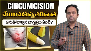 సున్తీ ఆపరేషన్ తర్వాత  Post Operative Care For Circumcision in Telugu  Health Tisp  Vikram Tv [upl. by Connie]