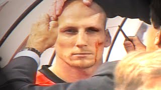 Jaap Stam eyebrow injury  EURO 2000 Netherlands v Czech Republic [upl. by Aim876]