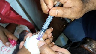 Child Meropenem 250mg amp Amikacin intravenous injection Video 24 Ep 71 Injection Tips [upl. by Lisette]