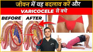 10 Lifestyle changes to stop growing varicocele  Dr Gaurav Gangwani Interventional Radiologist [upl. by Ariamat]