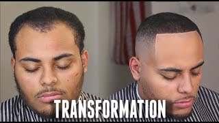 HAIRCUT TRANSFORMATION  Receding Hairline amp Widows Peak Tips HD [upl. by Akihdar]