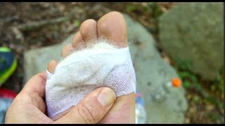 Blister Prevention on the Trail [upl. by Leeban]