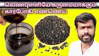 karboga arisi benefits vitiligo best oilment tamil [upl. by Sieracki688]