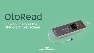 OtoRead How to interpret the SNR graph test screen [upl. by Aicenert]