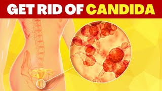 HOW TO TREAT CANDIDA NATURALLY in 5 STEPS [upl. by Eisaj557]