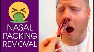 NASAL PACKING REMOVAL  Brutal Compilation [upl. by Aissac]