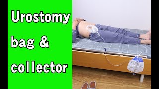 How to use one piece systerm Urostomy bag [upl. by Saitam782]