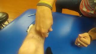 How to Fit and Use a Dyna Splint Ankle Brace for Equinus Contracture [upl. by Ahsiekahs280]