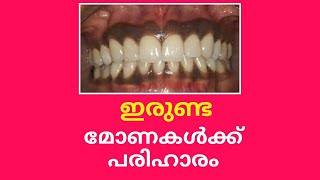 നിങ്ങളുടെ മോണ ഇരുണ്ടനിറത്തിലുള്ളതാണോ Medical Treatment For Black Gums Malayalam  D care Tips [upl. by Sarson209]