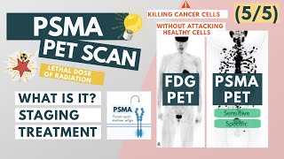 What is a PSMA PET scan  Overview for Med Students  Urology [upl. by Lavona837]