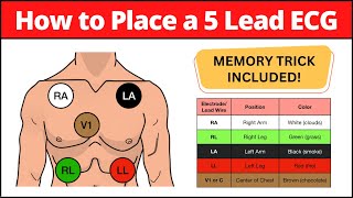 How to Place a 5 Lead ECG MNEMONIC Electrode Placement Made Easy nursing [upl. by Elleon]