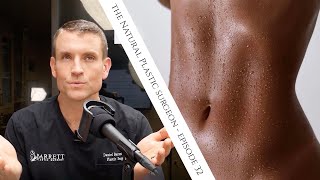 32 Everything You Need To Know About Liposuction [upl. by Ziom551]