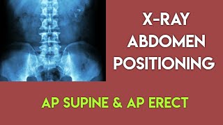 x ray abdomen positioning  x ray abdomen erect  x ray abdomen supine position [upl. by Lacim]