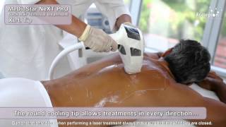 MeDioStar NeXT PRO XL  Training video for hair removal with SMOOTHPULSE mode from Asclepion [upl. by Spratt]