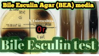 Bile Esculin Agar or Bile Esculin test culture media lecture 28 [upl. by Idnic]