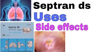 Septran ds tablets  how to use Cotrimoxazole  uses  side effects  precautions in urdi hindi [upl. by Ehcropal887]