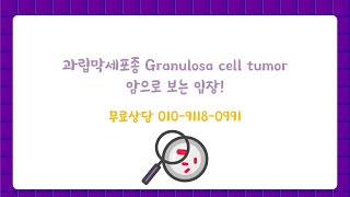 과립막세포종 Granulosa cell tumor 암으로 보는 입장 [upl. by Adolph]