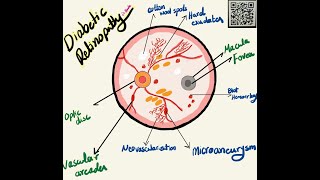 Retinal Abnormalities findings in Ophthalmoscope Examination  Made Easy   مشاكل الشبكية [upl. by Arick46]