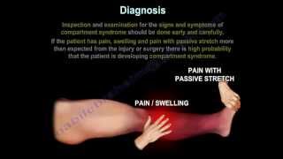 Compartment SyndromeDiagnosisPressuresFasciotomy Everything You Need To Know Dr Nabil Ebraheim [upl. by Ogata]