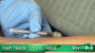 Intradermal Injection Upper Forearm ivyVILOsIvy Tech Community College School of Nursing [upl. by Sorilda]