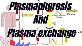 Plasmapheresis part1Plasma exchangeTherapeutic plasma exchangetherapeutic plasmapheresisTPEPE [upl. by Henricks955]