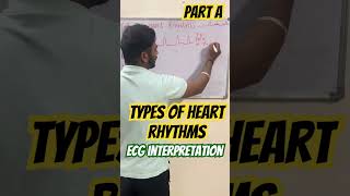 Ecg kaise padhe ecg interpretation ecg basicsecg kaise dekhte hai [upl. by Nydnarb877]