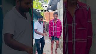 7days paralysis patient recovery Chiropractic treatment kumbakonam Aduthurai call9994536638 [upl. by Silyhp]