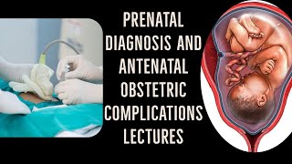 ANTENATAL OBSTETRIC COMPLICATIONS lecture 4 OLIGO and POLYHYDROAMNIOS made simple [upl. by Neffets883]