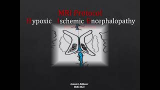 HIE Hypoxic Ischemic Encephalopathy [upl. by Lucas]