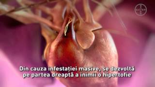 Viermele cardiac Dirofilaria immitis [upl. by Assej]