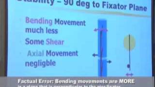 Lecture  Relevant Biomechanics of External Fixators [upl. by Eads]