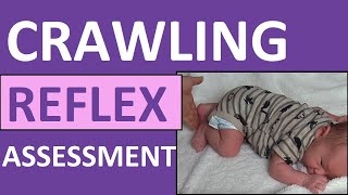 Crawling Reflex Assessment Infant  Newborn  Bauer Reflex  Pediatric Nursing NCLEX [upl. by Piks]