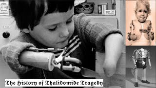 The TERRIFIC History of Thalidomide Tragedy [upl. by Ennagroeg]