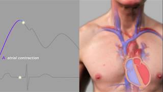 Easy Measurement of Jugular Venous Pressure [upl. by Tennes]