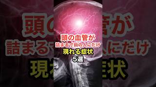 頭の血管が詰まる寸前の人にだけ現れる症状【5選】 長寿命 [upl. by Ahsienroc]