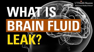 What is Brain Fluid Leak Symptoms and Treatment for CSF Leak [upl. by Idnarb]