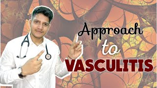 VASCULITIS  Classification  Approach  Management [upl. by Yduj]