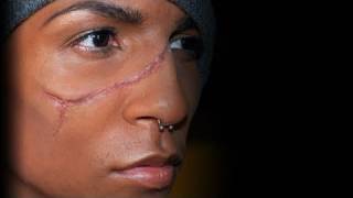 quotScarring Liquidquot Rigid Collodion [upl. by Goss670]