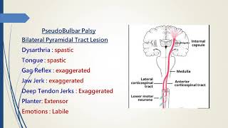 Pseudobulbar Palsy [upl. by Maggee547]