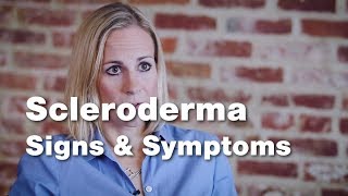 Signs and Symptoms of Scleroderma  Johns Hopkins [upl. by Buff733]