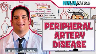 Peripheral Artery Disease [upl. by Ayrolg]