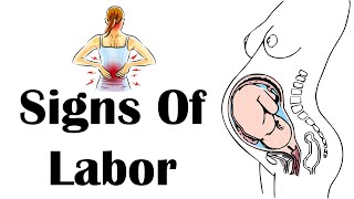 Signs Of Labor  Stages amp Signs Of Labor What Are The Early amp Late Signs Of labor [upl. by Onirefes193]