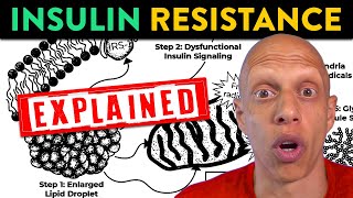 What Causes Insulin Resistance Unpacking the Effects of Excess Fat  Mastering Diabetes [upl. by Malek864]