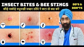 INSECT BITE amp BEE STING  How to Cure  कीड़े मकोड़े मधुमखी ततैये ने कटा DrEducation Hindi  Eng [upl. by Naujet]