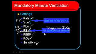 Mandatory Minute Ventilation MMV [upl. by Auqined323]