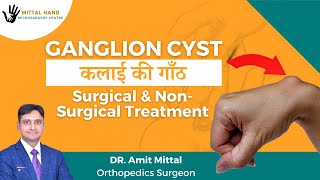 कलाईकीसिस्ट Wrist Ganglion Cyst Hindi Ganglion Cyst Surgical and non Surgical Treatments [upl. by Rudich]