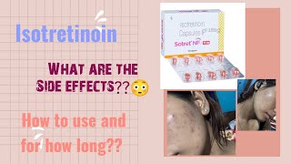 Side effects  Sotret Nf 16mg review acne isotretinoin clearskin clearskinjourney [upl. by Aney]