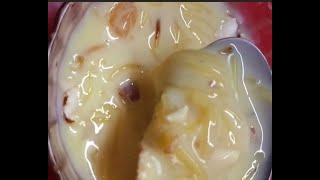 Easy sweet recipe Semiya custard 🍮 quick and simple recipe [upl. by Alvarez122]